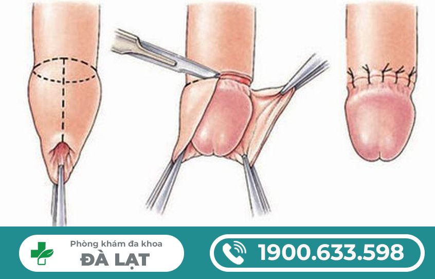 Hình ảnh minh họa